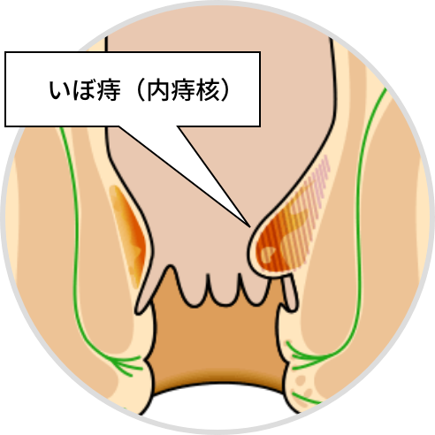 広島大腸肛門クリニック