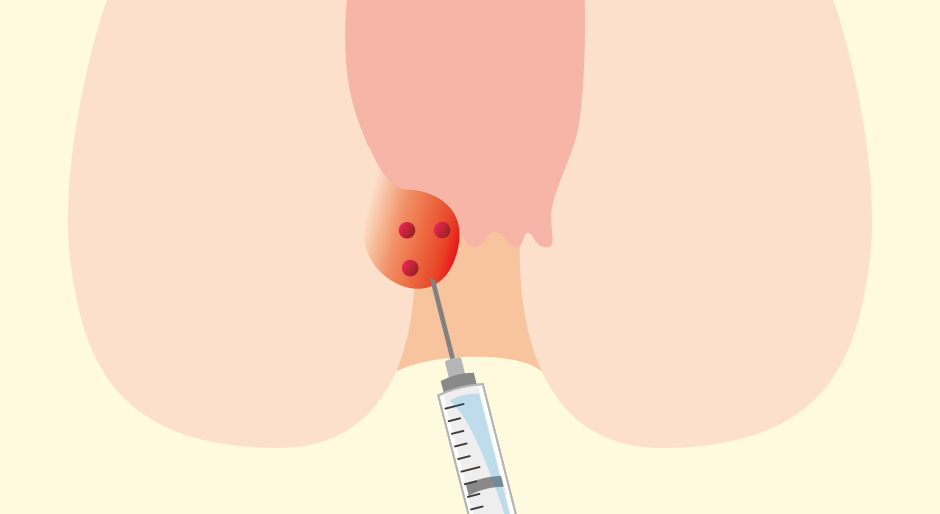 広島大腸肛門クリニック