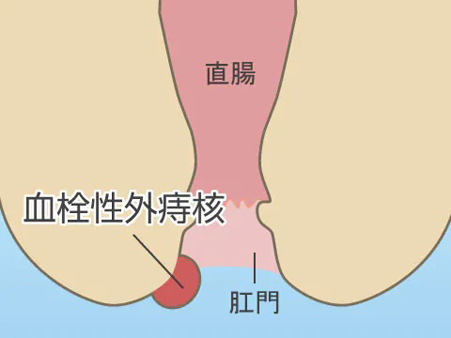 広島大腸肛門クリニック