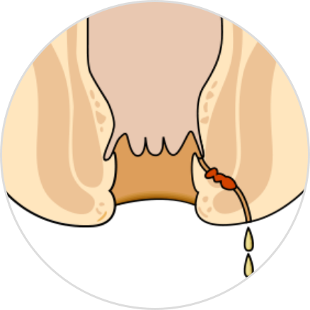 広島大腸肛門クリニック