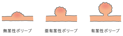 広島大腸肛門クリニック